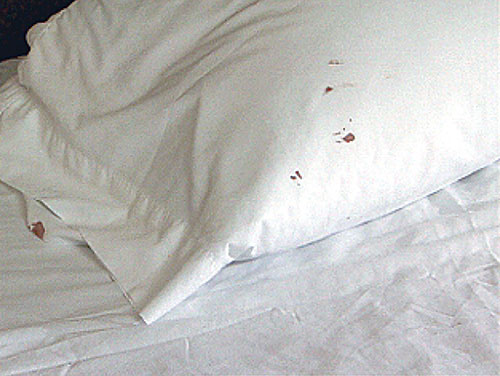 bed-bug-pillow-