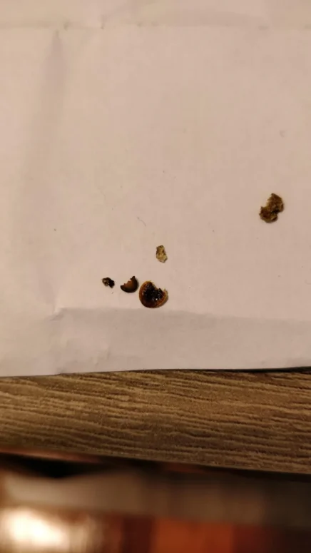 bed bug shell image 